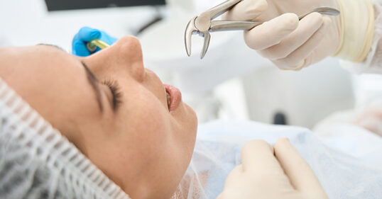 tooth-extraction-in-prince-rupert